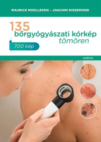 135 bőrgyógyászati kórkép tömören 1.Kép