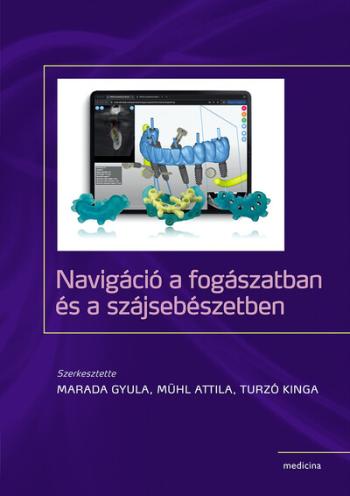 Navigáció a fogászatban és a szájsebészetben Kép