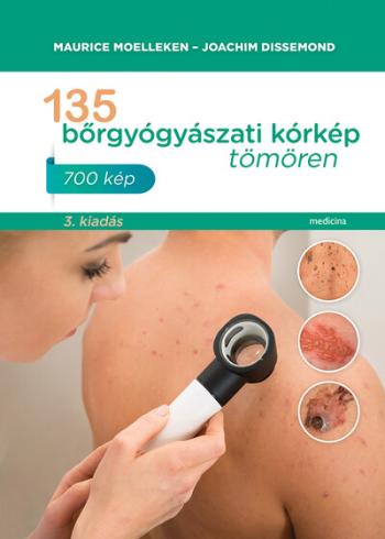 135 bőrgyógyászati kórkép tömören (új kiadás) Kép